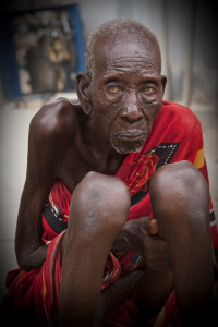 Cirugia en turkana 2014